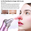 Electric Blackhead Remover Pore Vacuum Suction Diamond Dermabrasion Face Cleaner - Vortex Trends