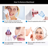 Electric Blackhead Remover Pore Vacuum Suction Diamond Dermabrasion Face Cleaner - Vortex Trends