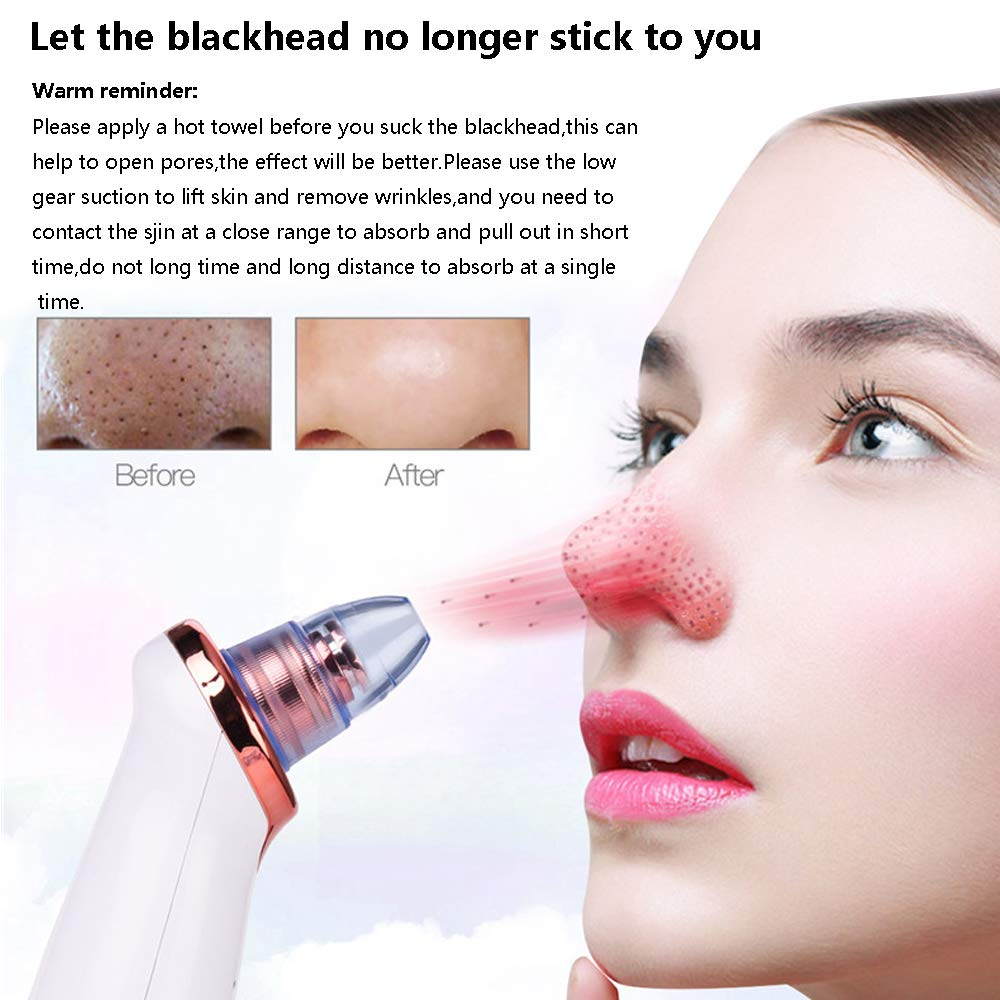 Electric Blackhead Remover Pore Vacuum Suction Diamond Dermabrasion Face Cleaner - Vortex Trends